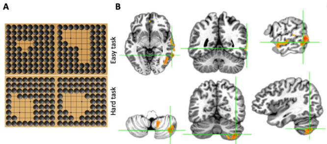 The neural basis of intuitive approximate number system in board game Go experts