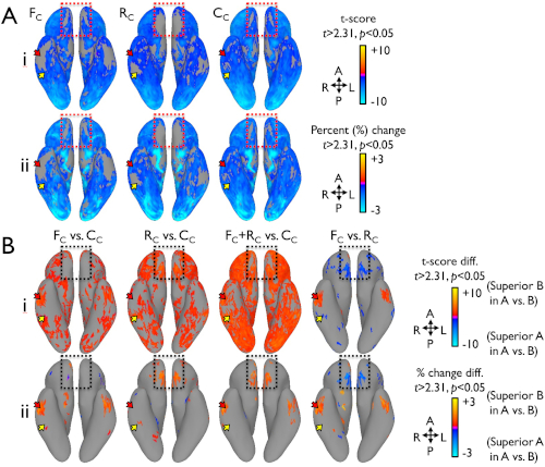 Minimizing Susceptibility-Induced BOLD Sensitivity Loss in Multi-Band accelerated fMRI using Point Spread Function Mapping and Gradient Reversal