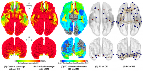 Improved Resting-state Functional MRI using Multi-echo Echo Planar Imaging on a compact 3T MRI scanner with high-performance gradients